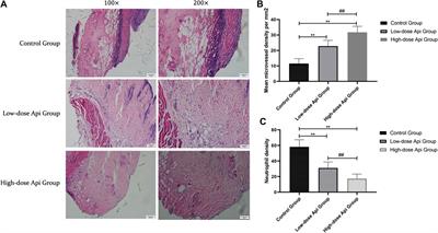 Effects of Apigenin Treatment on Random Skin Flap Survival in Rats